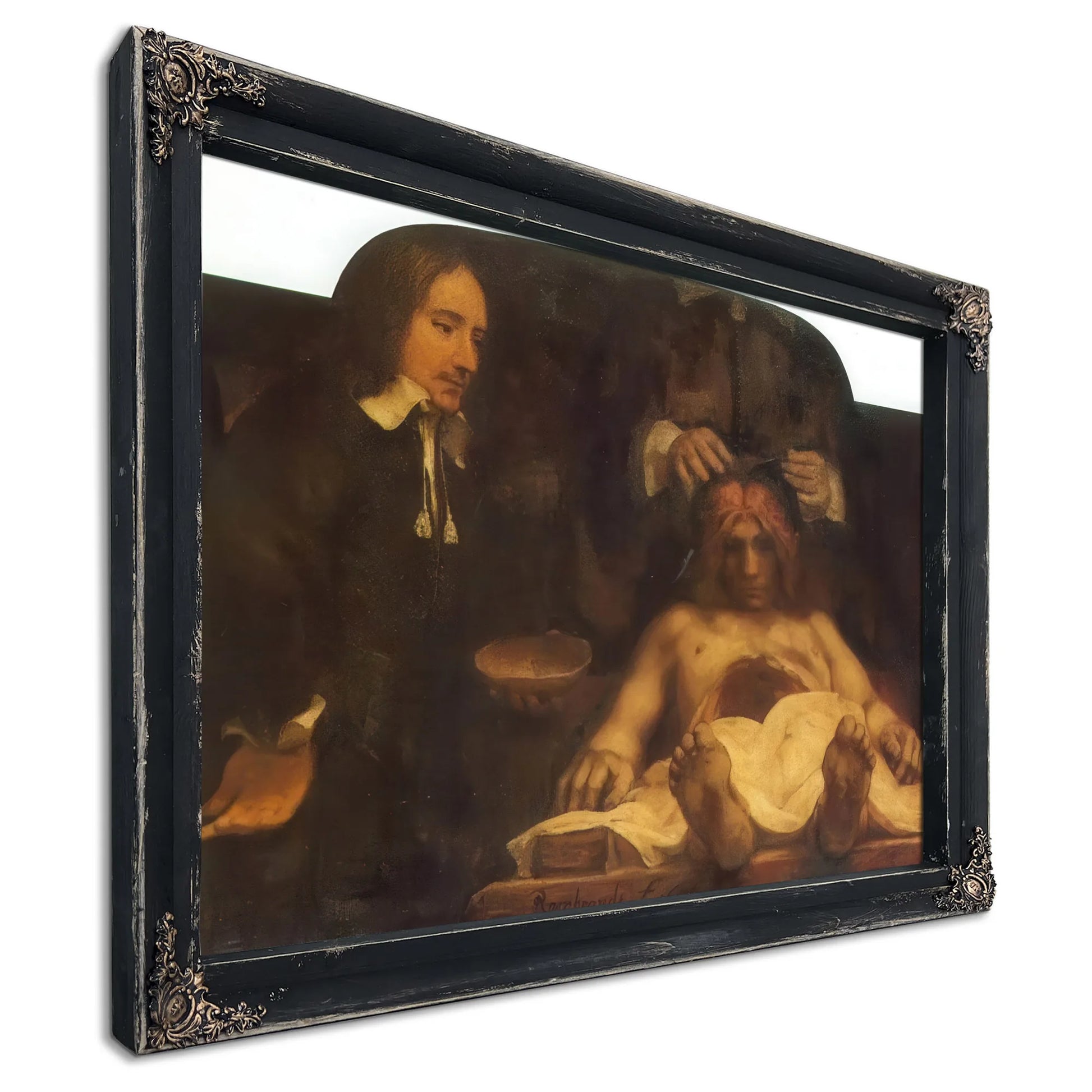 The Anatomy Lesson Of Dr By Rembrandt Fine Art Print