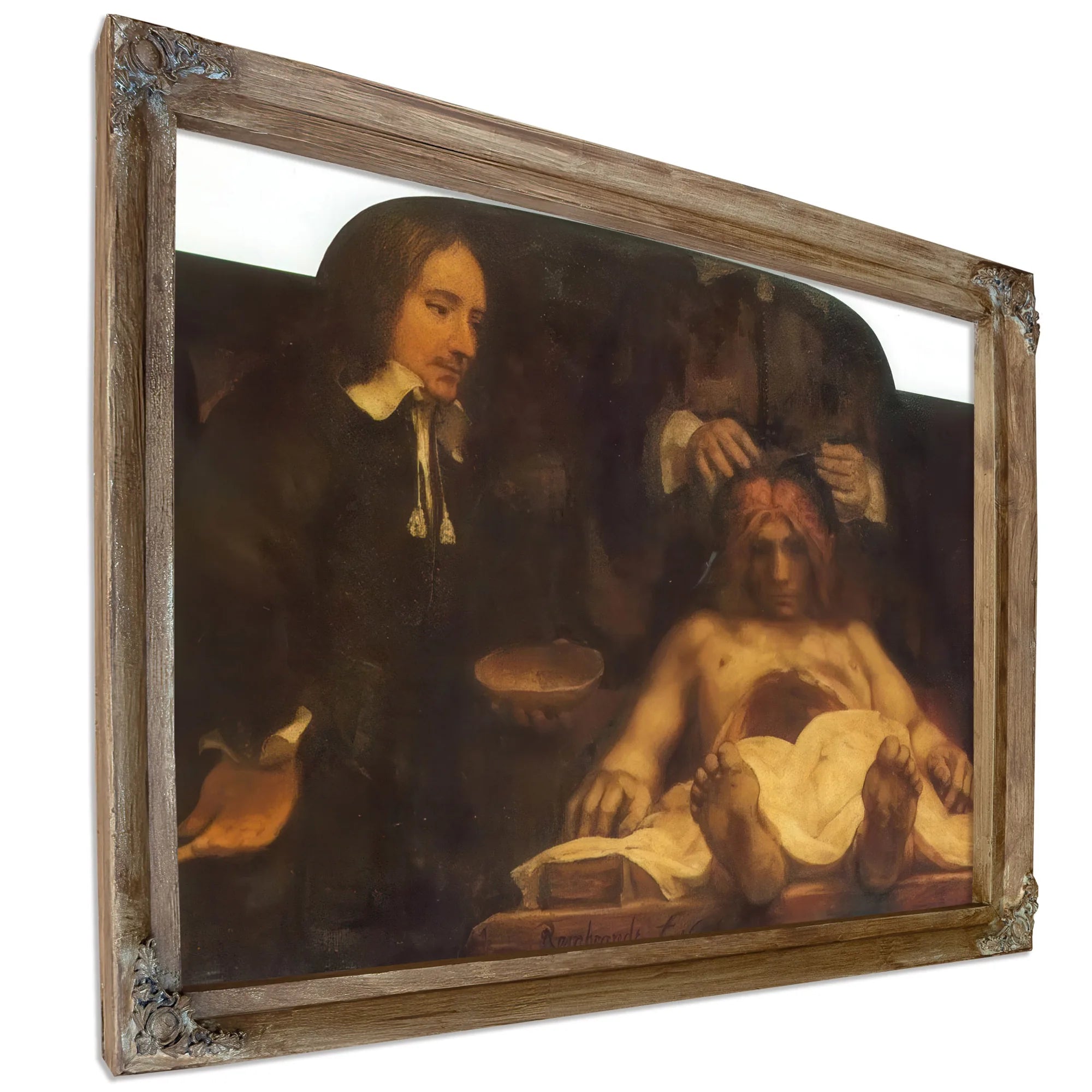 The Anatomy Lesson Of Dr By Rembrandt Fine Art Print