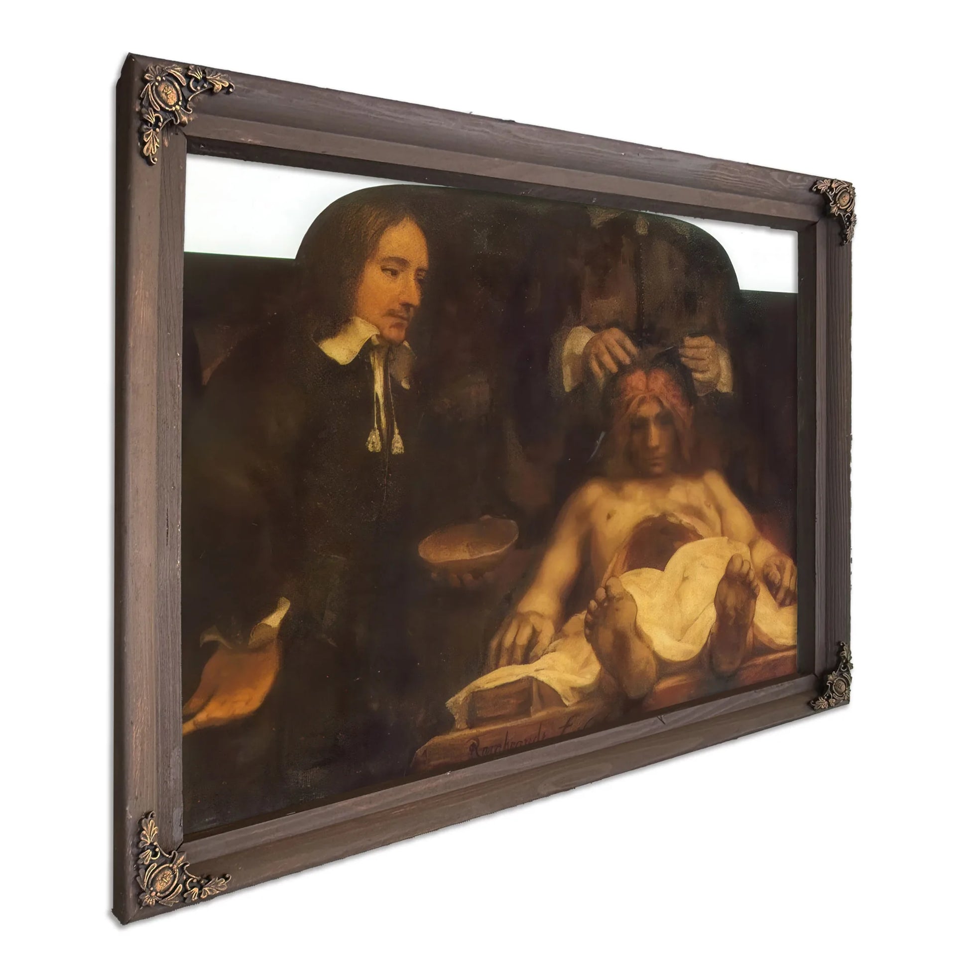 The Anatomy Lesson Of Dr By Rembrandt Fine Art Print