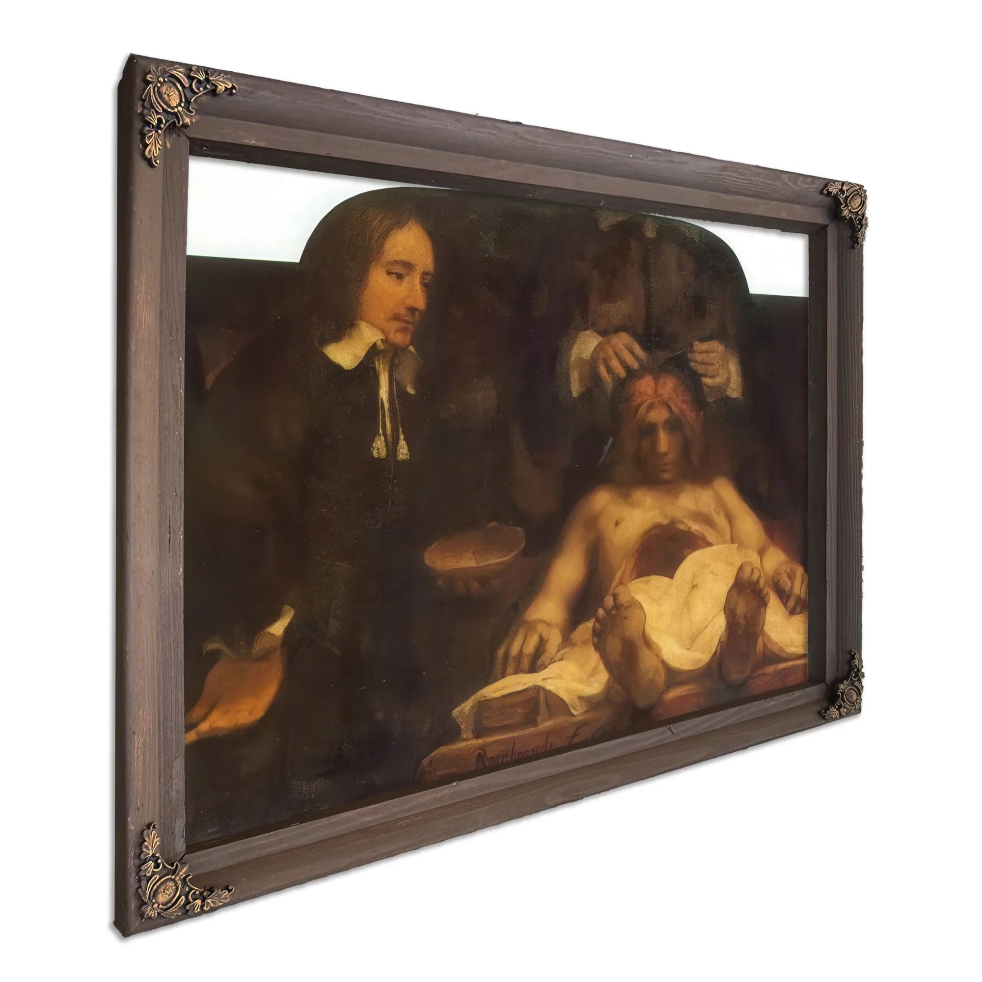 The Anatomy Lesson Of Dr By Rembrandt Fine Art Print
